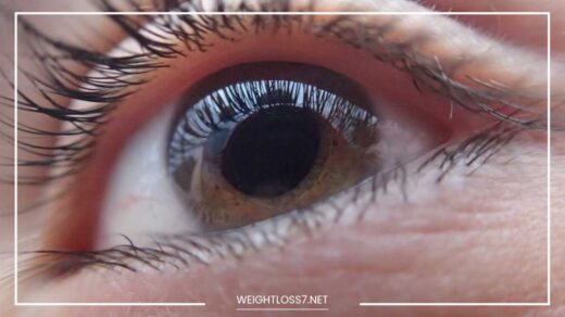 Glaucoma
