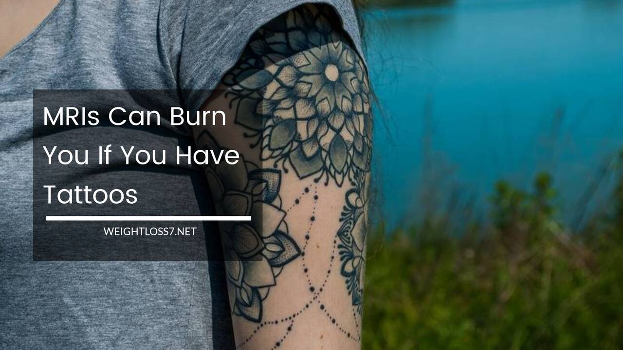 MRIs Can Burn You If You Have Tattoos