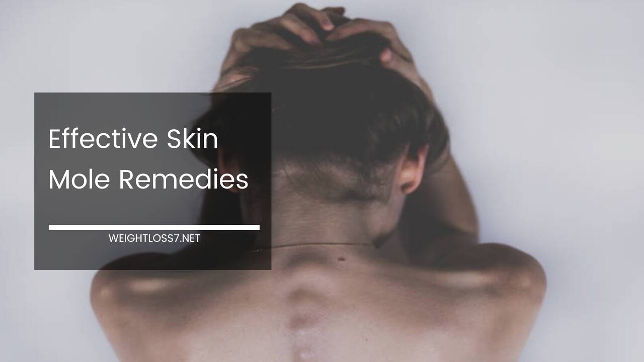 Skin Mole Remedies