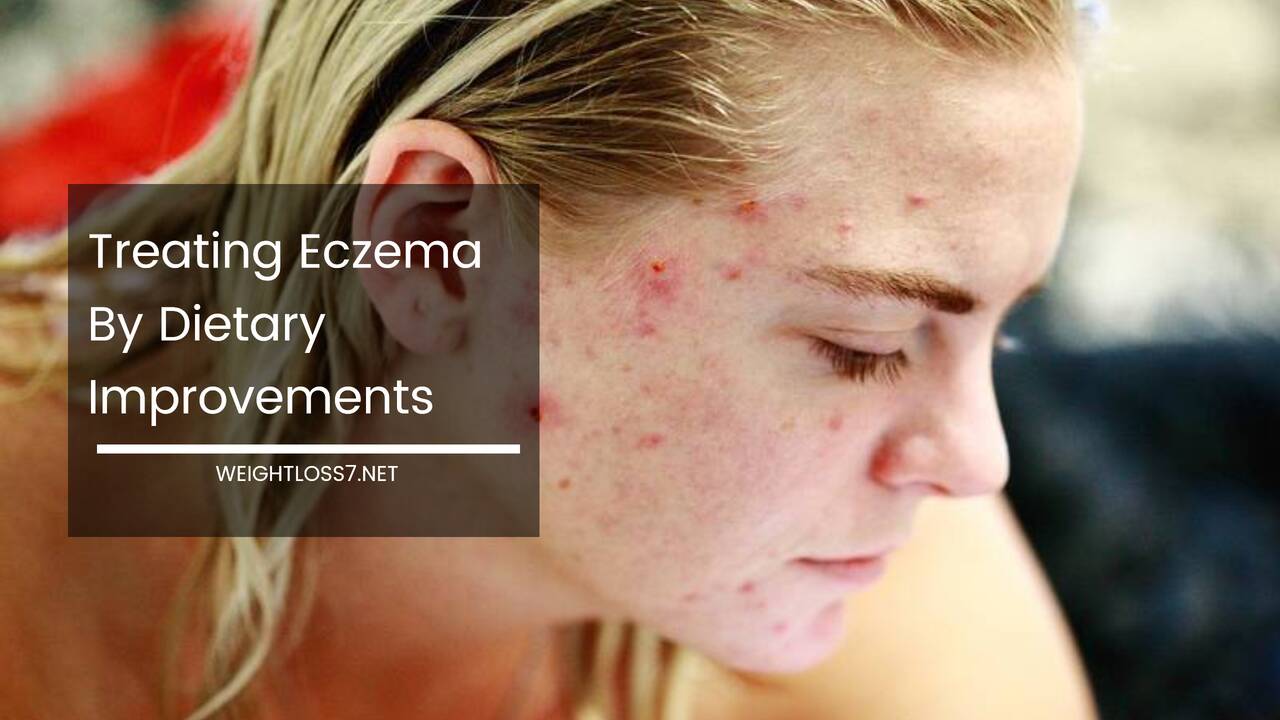Treating Eczema